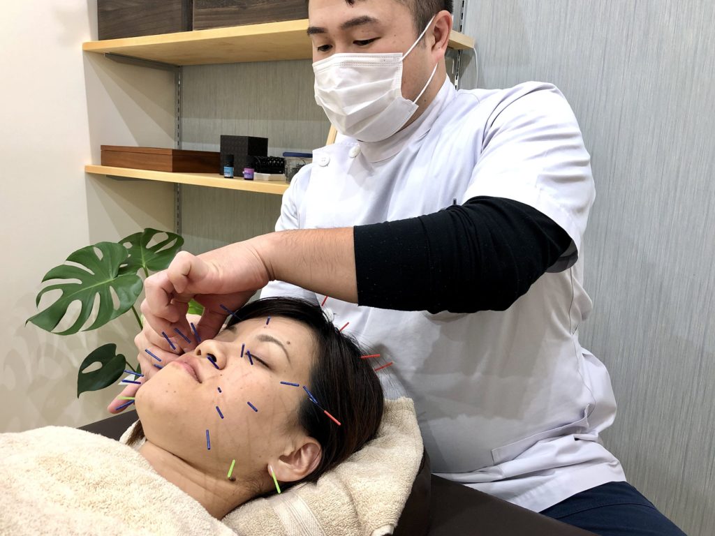 美容鍼