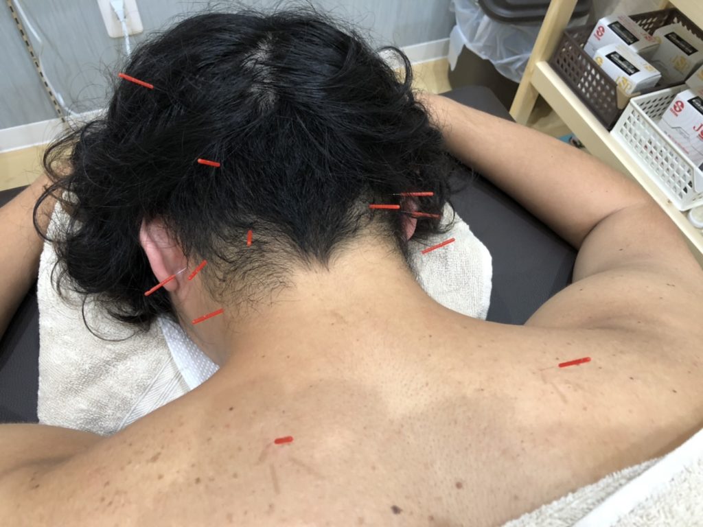 松戸 鍼灸院