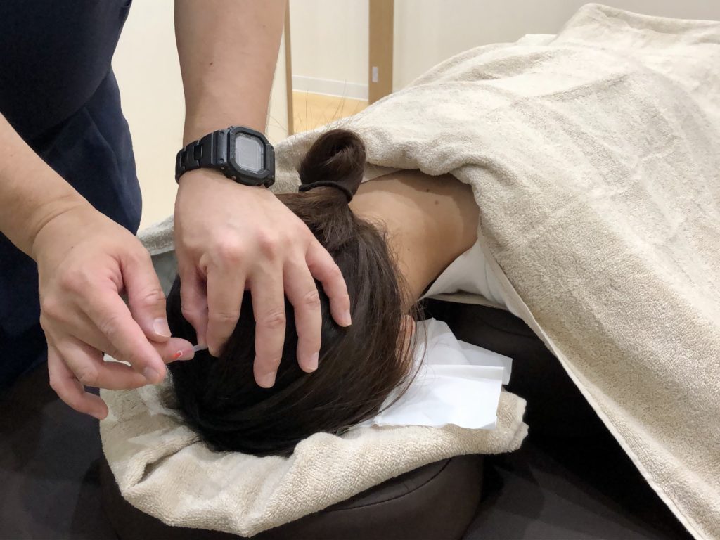 自律神経失調症 松戸 鍼灸